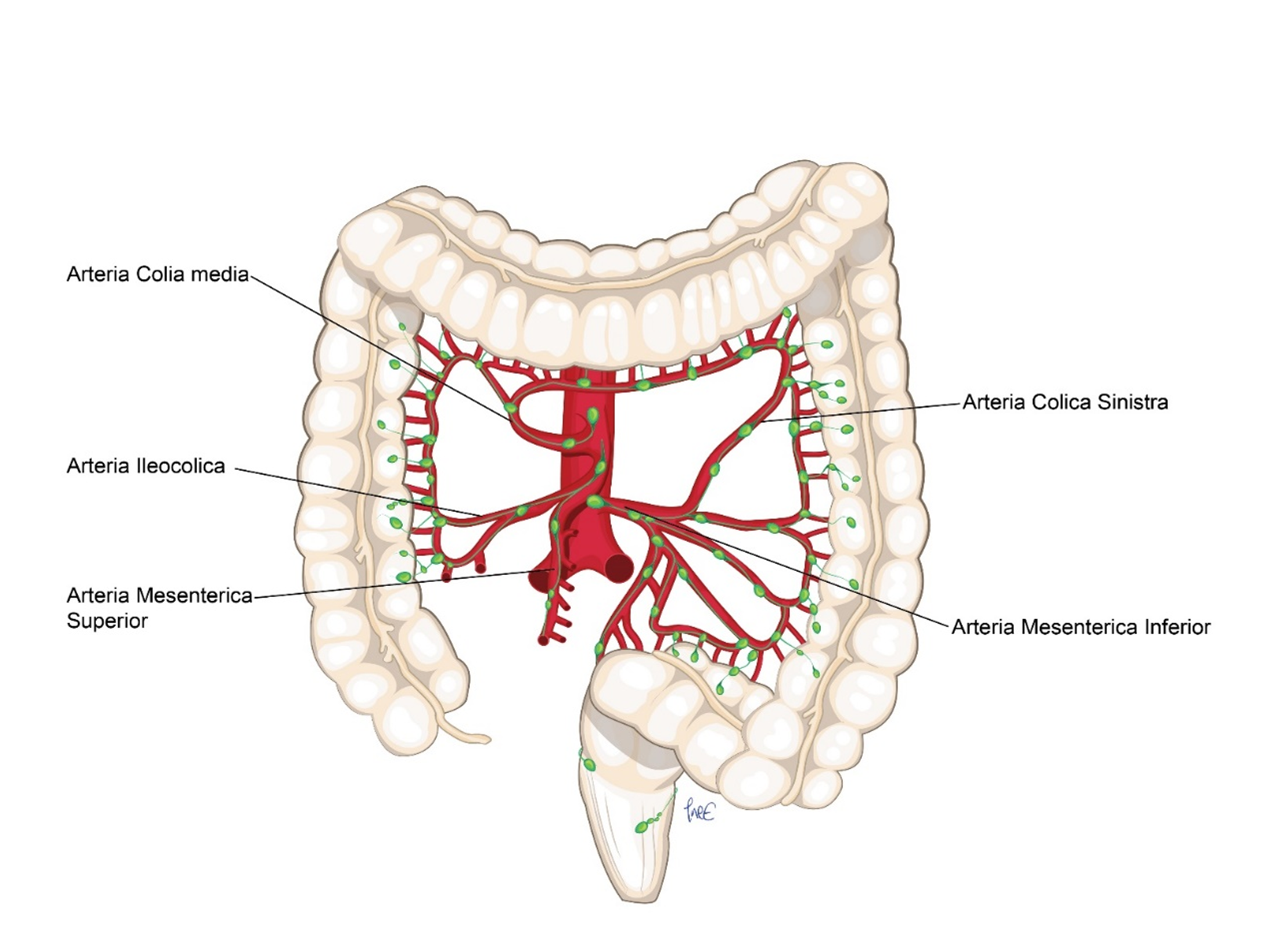 Figur 1: Arteriell blodforsyning til tykktarmen. Skissen viser den vanligste arterieanatomien. Arteria colica dextra er ikke tegnet inn fordi den er fraværende hos 10%, og har variabel origo. (Origo fra arteria colica media, arteria ileocolica eller arteria mesenterica superior).