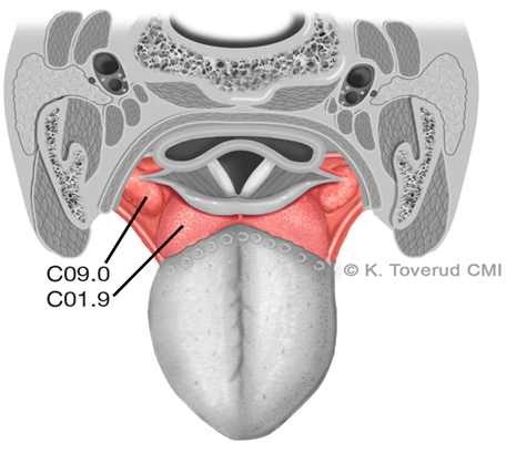 Figur 17.2: Anatomi tungebasis og tonsilleregion