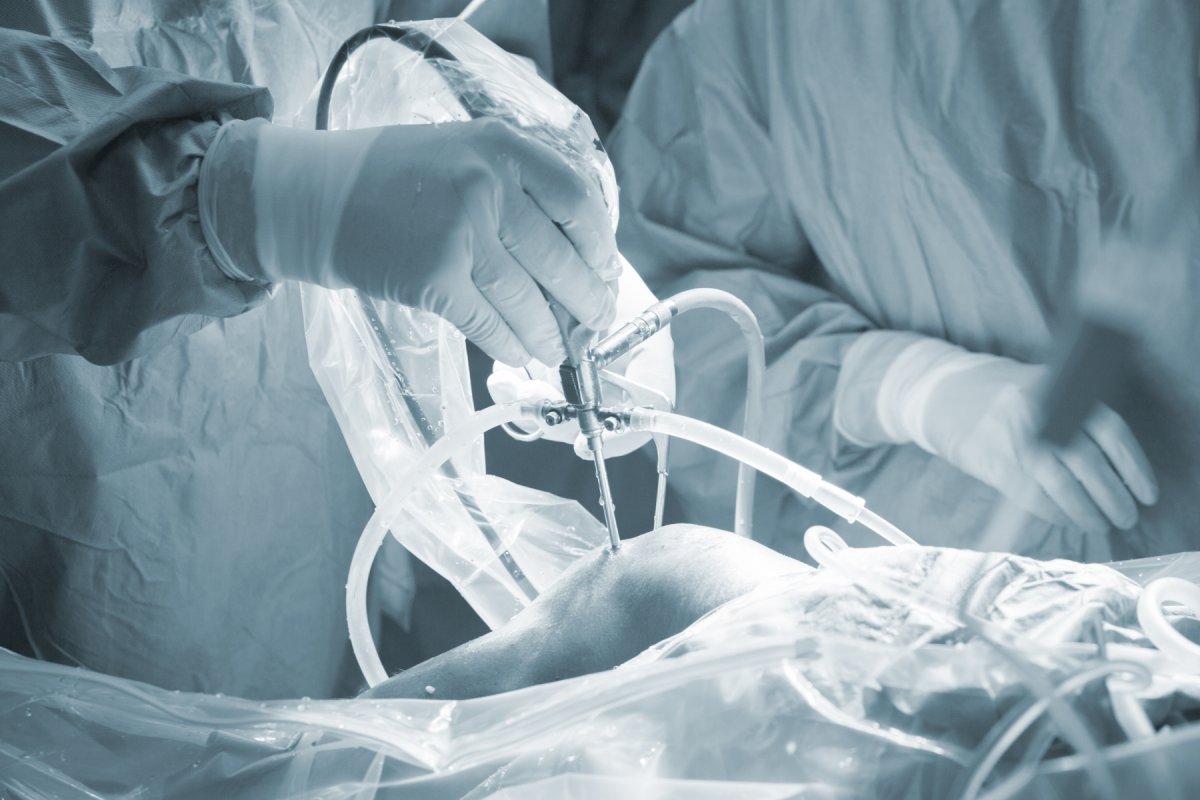 Knee-surgery-hospital-operation-foto Mostphotos-EDWARD OLIVE