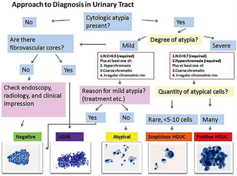Figur 3: Tilnærming til diagnose for urincytologier basert på Paris-systemet. Hentet fra Barkan et al. (2016). Copyright 2016 Elsevier. Gjengitt med tillatelse 2025. 