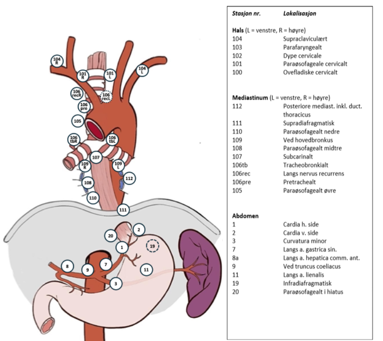 Figur 5: aktuelle lymfeknutestasjoner ved spiserørskreft i hht. Hentet fra Janjigian et al. (2021) CC-BY 4.0.