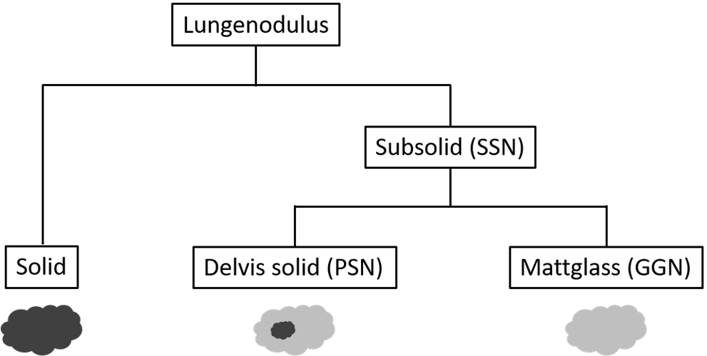 Figur 12 Inndeling av pulmonale noduli etter utseende på CT toraks