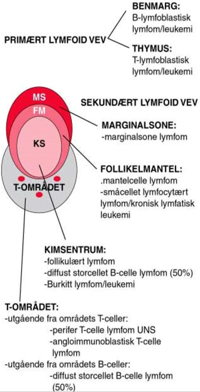 Lymfeknute, Lymfom.png